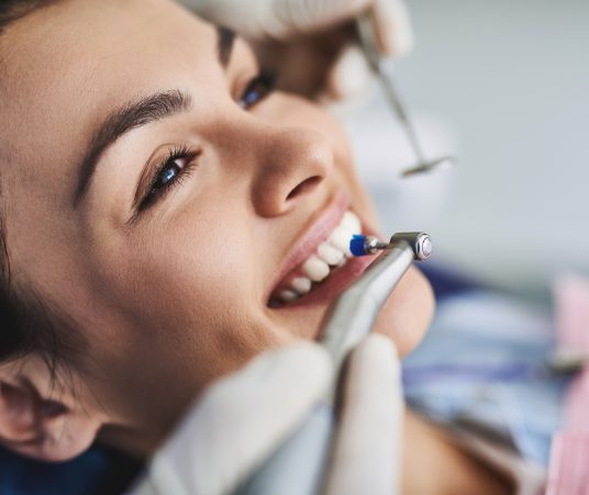 Over-the-Counter vs. Professional Teeth Whitening 