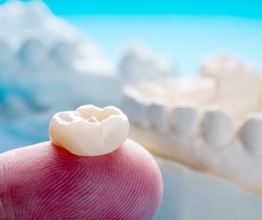 Three Purposes of Dental Crowns 