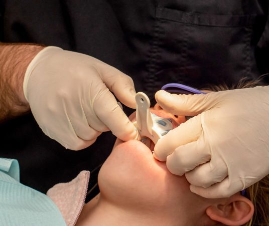 Preparing for Dental Bridges: What to Expect 