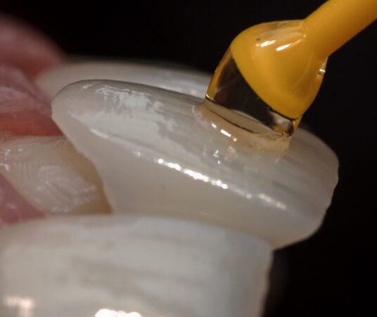 What Should I Know About the Dental Veneer Process?