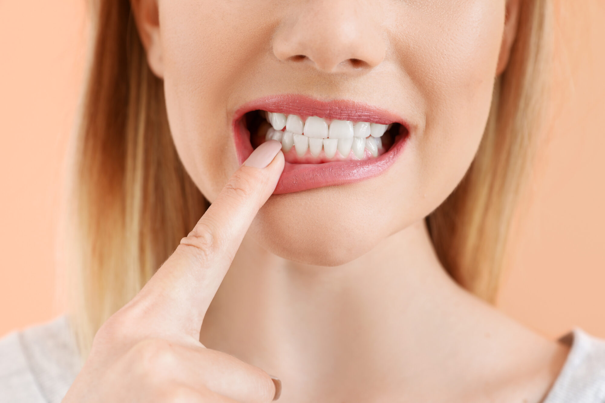 What Can I Do About Weak Tooth Enamel?
