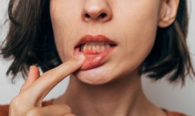 Why Is Gum Health Important?