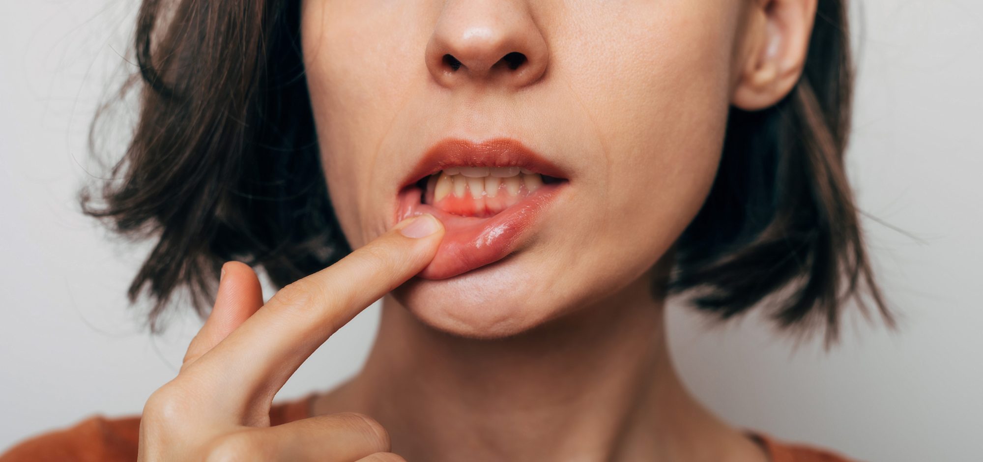 Why Is Gum Health Important?