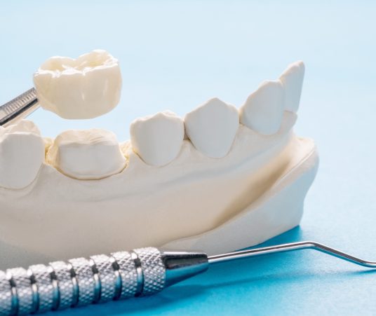 What are Same-Day Crowns Made Of?