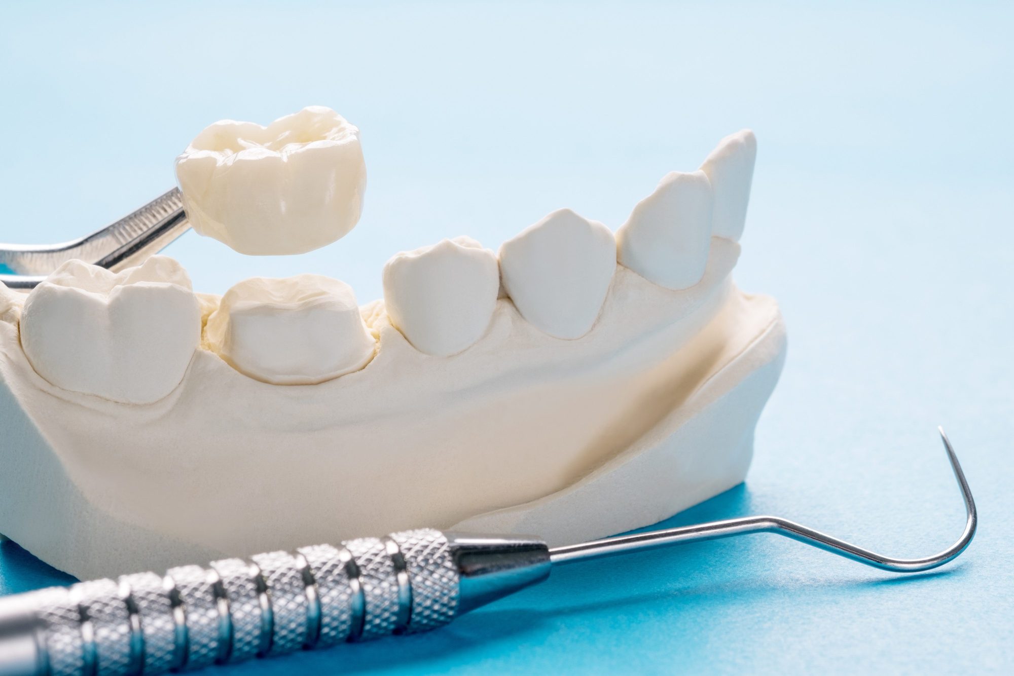 What are Same-Day Crowns Made Of?
