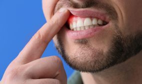 Can Diabetes Influence My Oral Health?