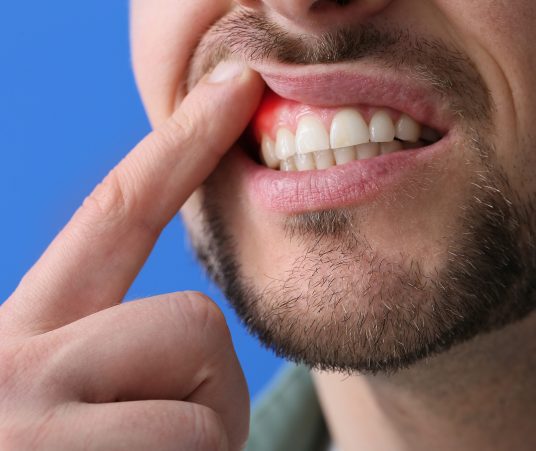 Can Diabetes Influence My Oral Health?