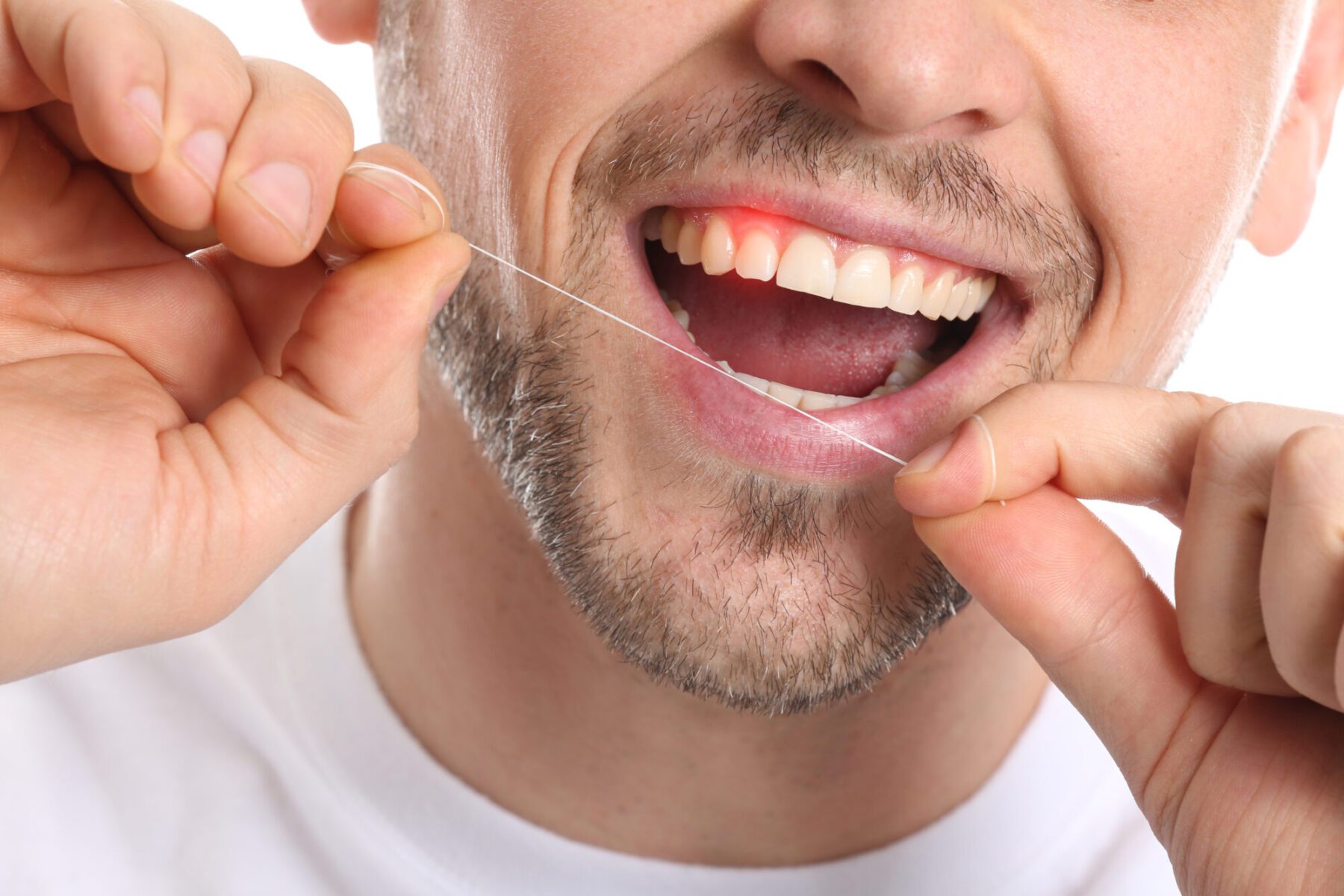 Why Do My Gums Hurt After Flossing?