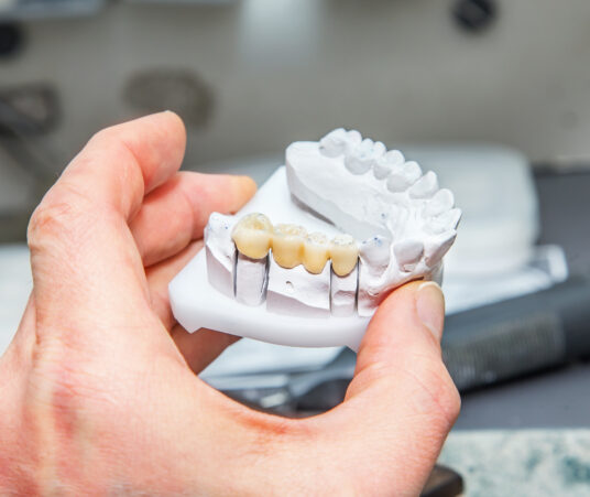 Can a Dental Bridge Be Repaired?