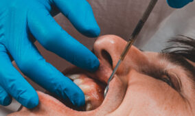 Can I Get Dental Implants if I Have Gum Disease?