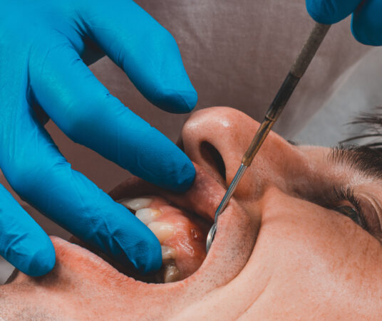 Can I Get Dental Implants if I Have Gum Disease?